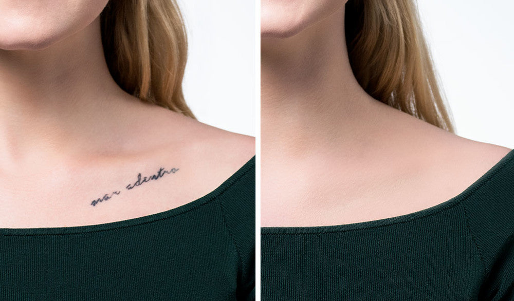 Der Vorher/Nachher Effekt des Camouflages bei Tattoos